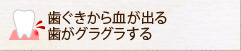 歯ぐきから血が出る・歯がグラグラする