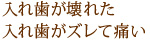 入れ歯が壊れた入れ歯がズレて痛い