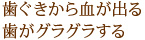 歯ぐきから血が出る歯がグラグラする